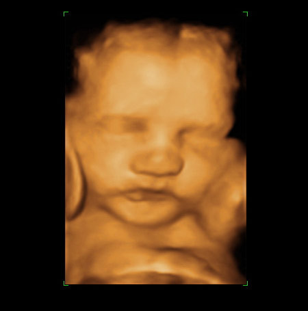 3d ultrasound Dallas